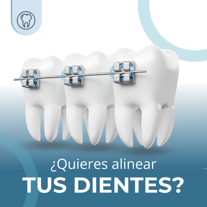 ¿Quieres enderesar tus dientes? No ocultes mas tu sonrisa por verguenza! En clinica dental Heins tenemos a los mejores ortodoncistas